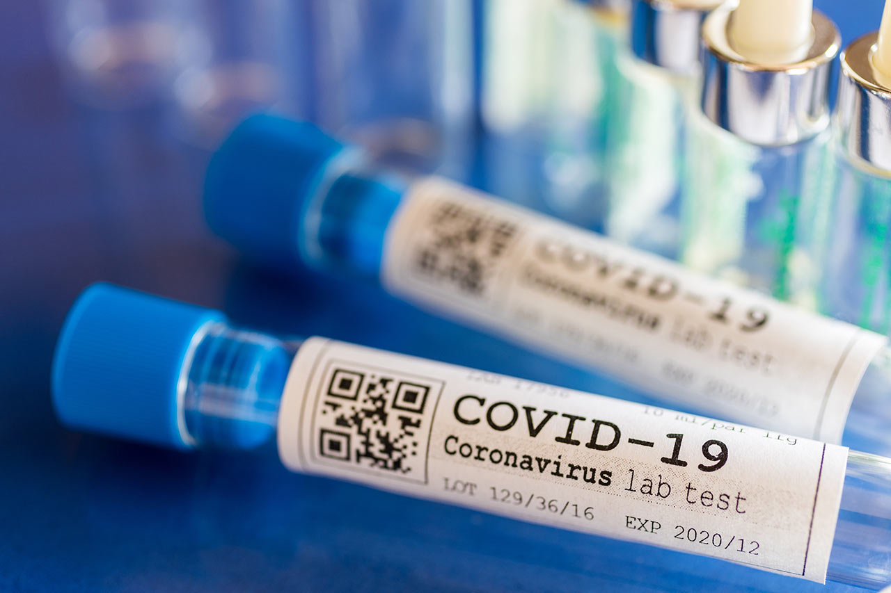 COVID-19 Testing: Which Tests, Where, and Why? [with a special FOCUS on ...